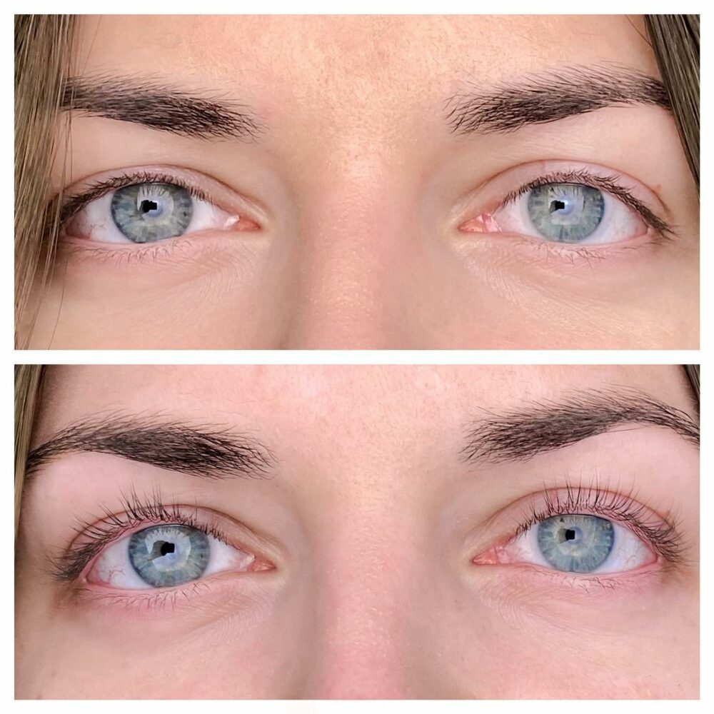 rehaussement des cils menton